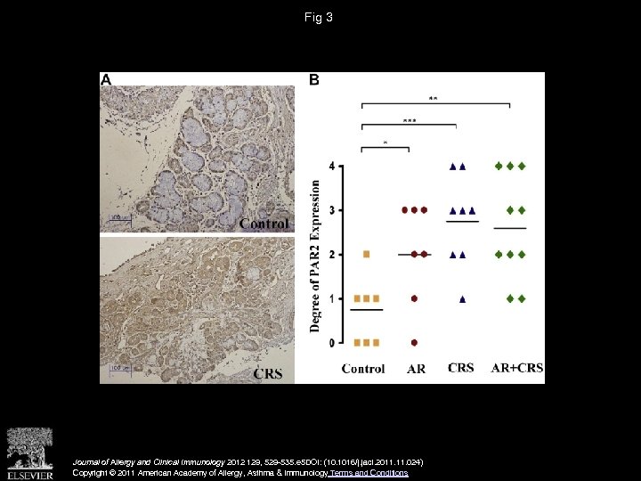 Fig 3 Journal of Allergy and Clinical Immunology 2012 129, 529 -535. e 5