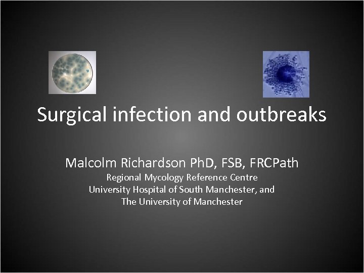 Surgical infection and outbreaks Malcolm Richardson Ph. D, FSB, FRCPath Regional Mycology Reference Centre