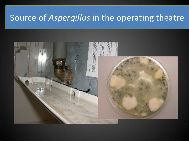 Source of Aspergillus in the operating theatre 
