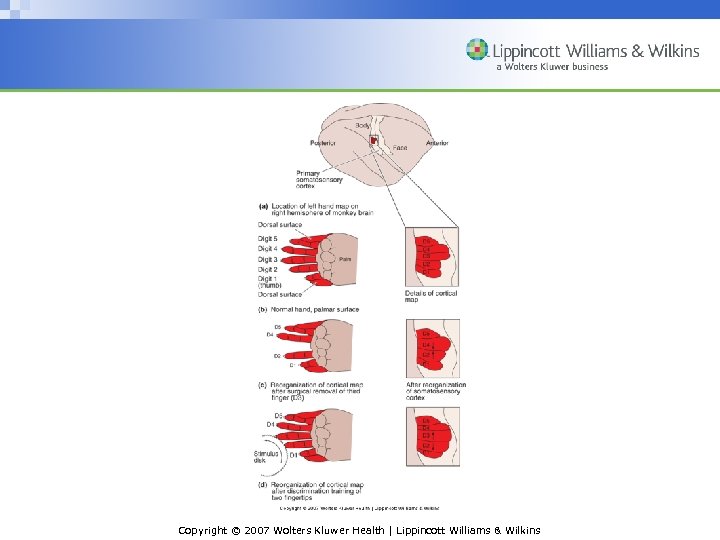 Copyright © 2007 Wolters Kluwer Health | Lippincott Williams & Wilkins 