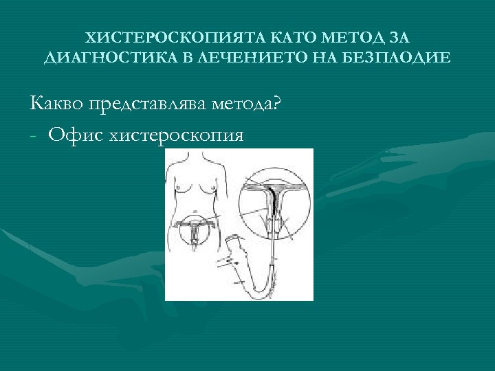 ХИСТЕРОСКОПИЯТА КАТО МЕТОД ЗА ДИАГНОСТИКА В ЛЕЧЕНИЕТО НА БЕЗПЛОДИЕ Какво представлява метода? - Офис