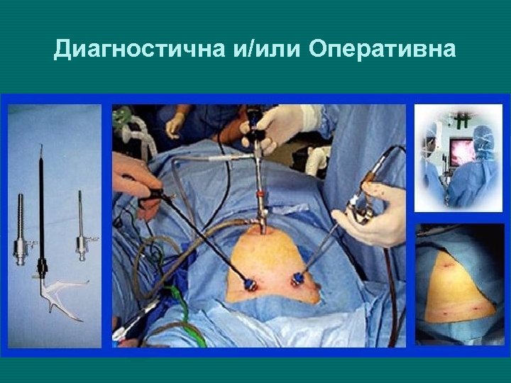 Диагностична и/или Оперативна 