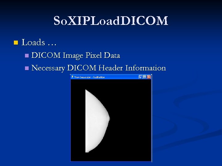 So. XIPLoad. DICOM n Loads … DICOM Image Pixel Data n Necessary DICOM Header