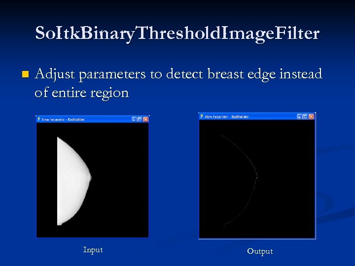 So. Itk. Binary. Threshold. Image. Filter n Adjust parameters to detect breast edge instead