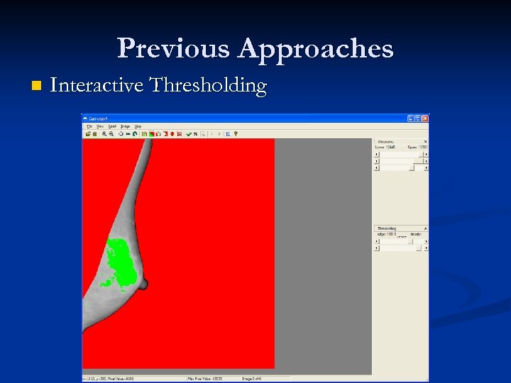 Previous Approaches n Interactive Thresholding 