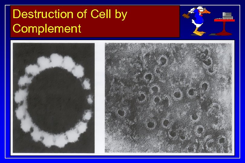 Destruction of Cell by Complement 