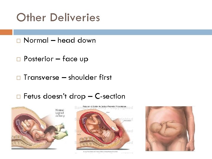 Other Deliveries Normal – head down Posterior – face up Transverse – shoulder first