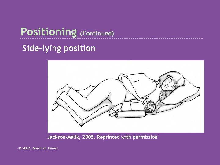 Positioning (Continued) Side-lying position Jackson-Malik, 2005. Reprinted with permission © 2007, March of Dimes