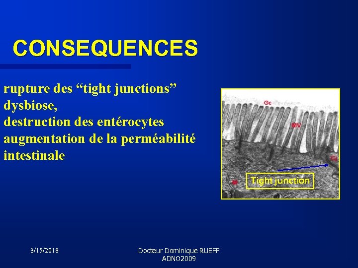CONSEQUENCES rupture des “tight junctions” dysbiose, destruction des entérocytes augmentation de la perméabilité intestinale