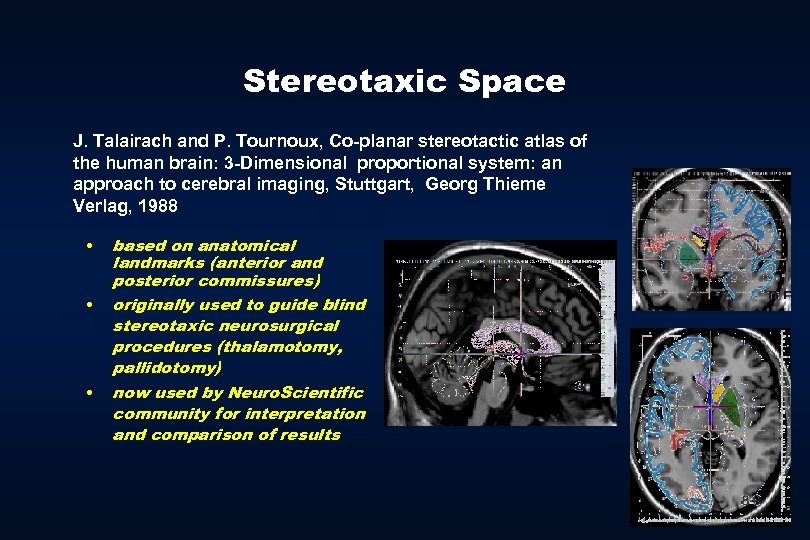 Stereotaxic Space J. Talairach and P. Tournoux, Co-planar stereotactic atlas of the human brain: