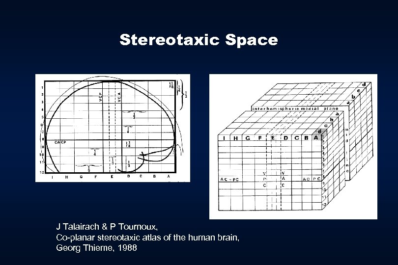 Stereotaxic Space J Talairach & P Tournoux, Co-planar stereotaxic atlas of the human brain,