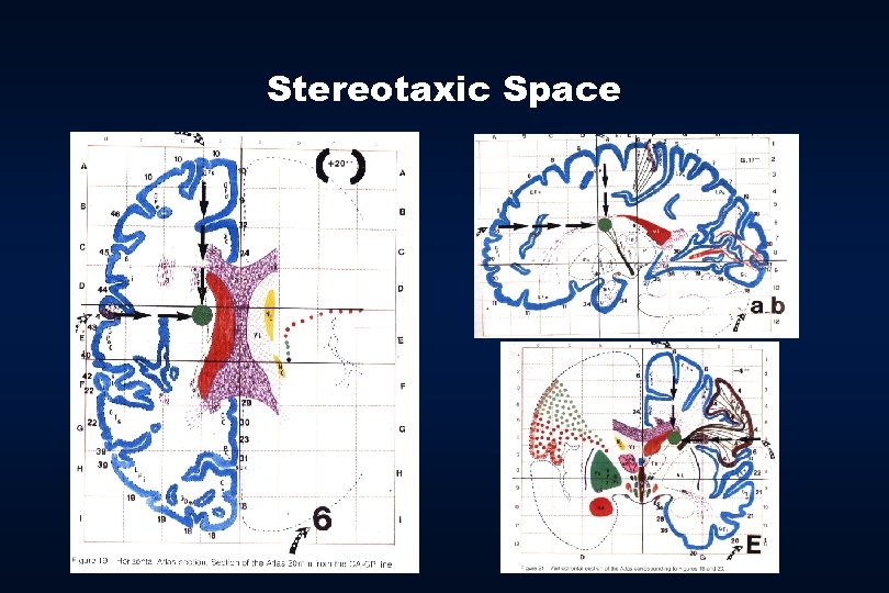 Stereotaxic Space 