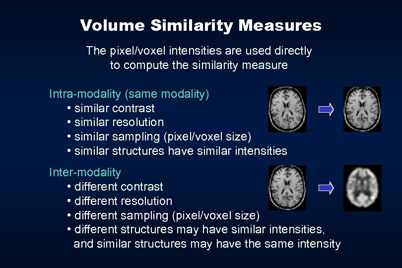 Volume Similarity Measures The pixel/voxel intensities are used directly to compute the similarity measure