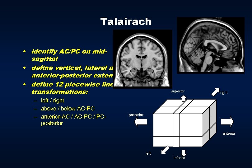 Talairach • identify AC/PC on midsagittal • define vertical, lateral and anterior-posterior extents •