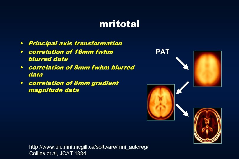 mritotal • Principal axis transformation • correlation of 16 mm fwhm blurred data •