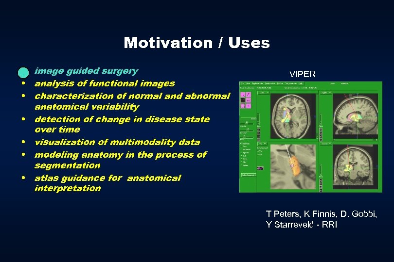 Motivation / Uses • image guided surgery • analysis of functional images • characterization