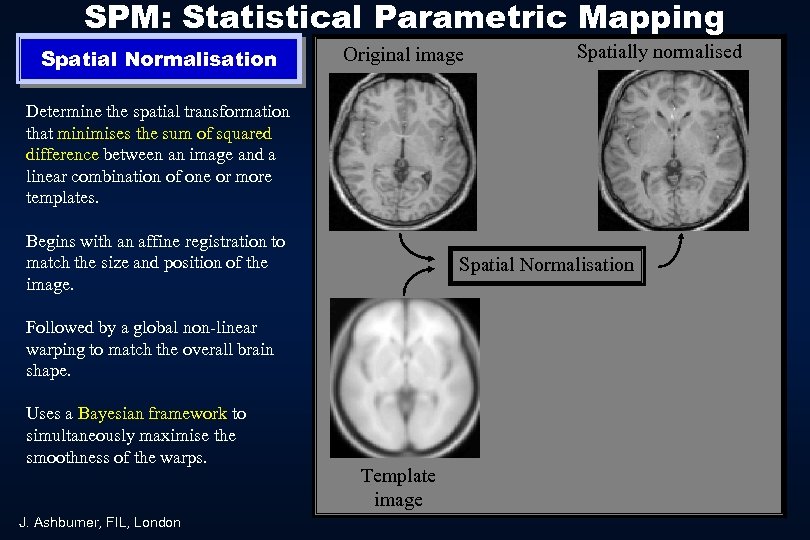 SPM: Statistical Parametric Mapping Spatial Normalisation Original image Spatially normalised Determine the spatial transformation