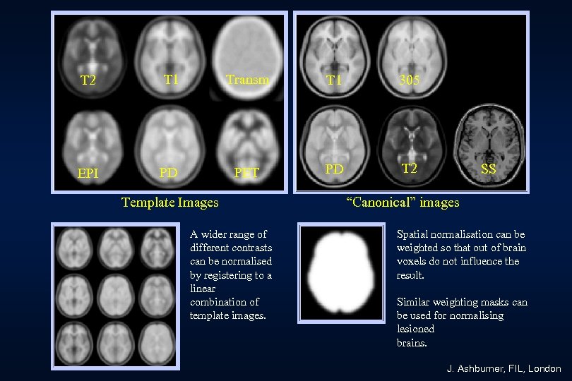 T 2 T 1 Transm T 1 305 EPI PD PET PD T 2