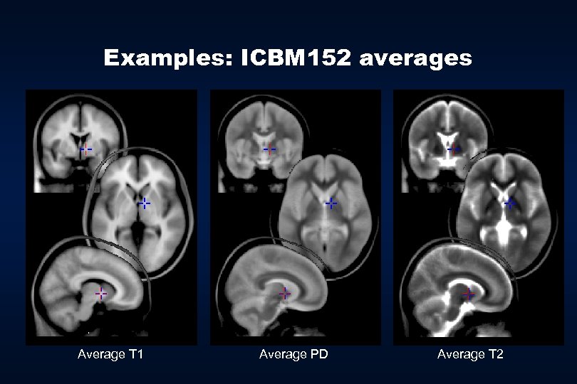 Examples: ICBM 152 averages Average T 1 Average PD Average T 2 