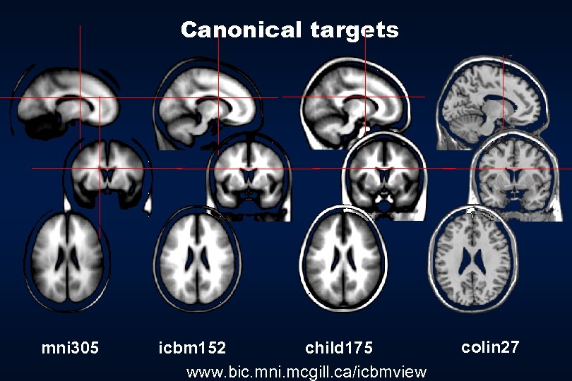 Canonical targets mni 305 icbm 152 child 175 www. bic. mni. mcgill. ca/icbmview colin