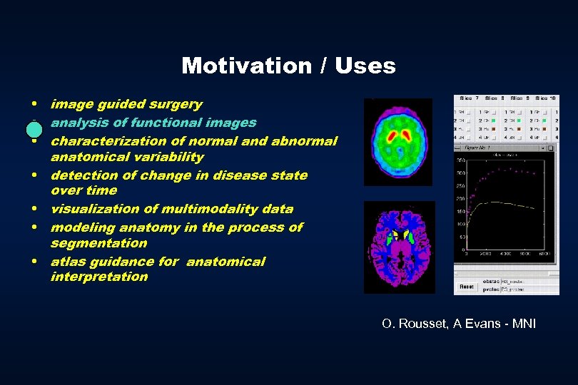 Motivation / Uses • image guided surgery • analysis of functional images • characterization