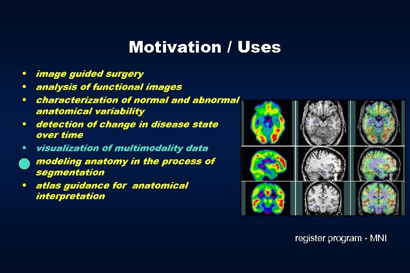 Motivation / Uses • image guided surgery • analysis of functional images • characterization