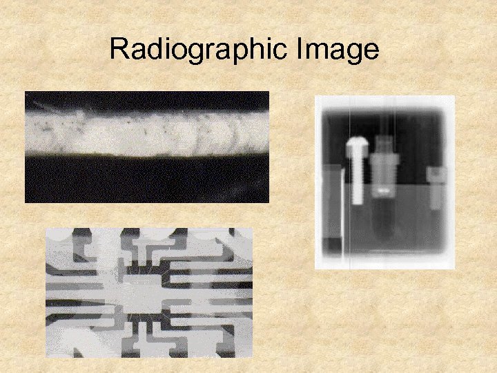 Radiographic Image 