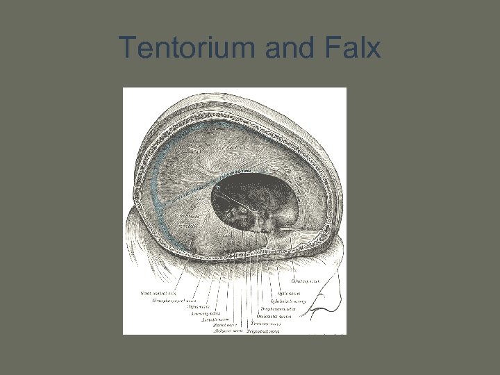 Tentorium and Falx 