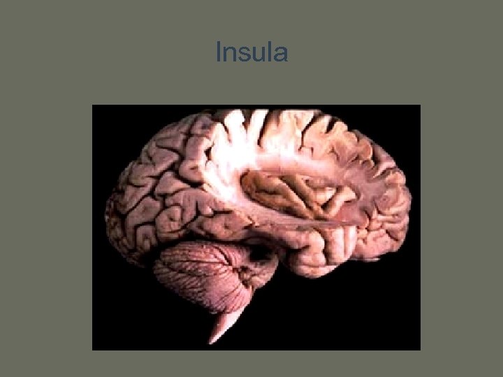 Insula 