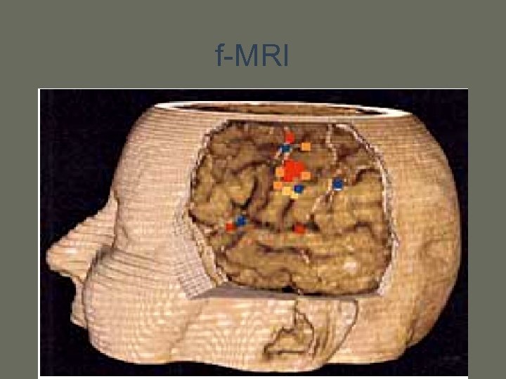 f-MRI 