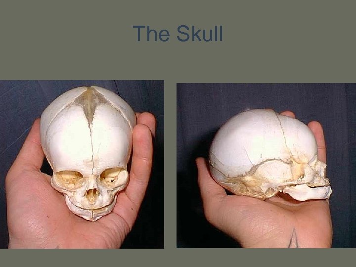 The Skull 