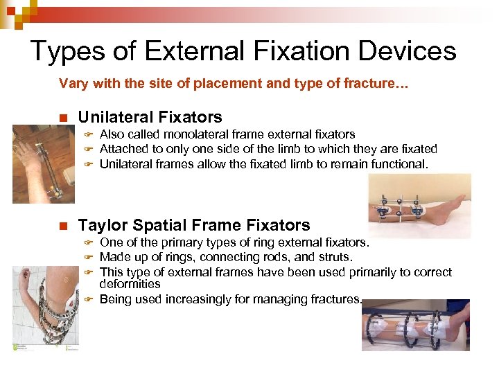 Types of External Fixation Devices Vary with the site of placement and type of