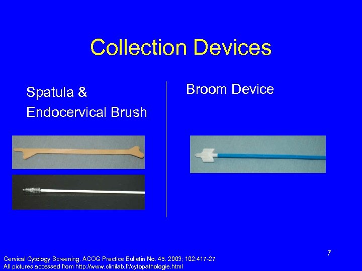 Collection Devices Spatula & Endocervical Brush Broom Device Cervical Cytology Screening. ACOG Practice Bulletin