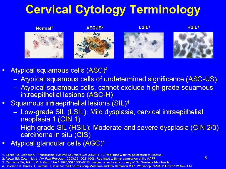 Cervical Cytology Terminology Normal 1 ASCUS 2 LSIL 3 HSIL 3 • Atypical squamous