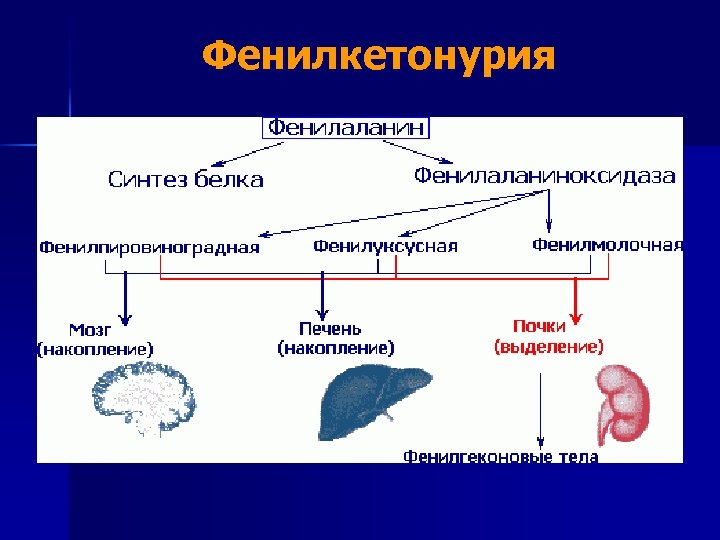 Фенилкетонурия 