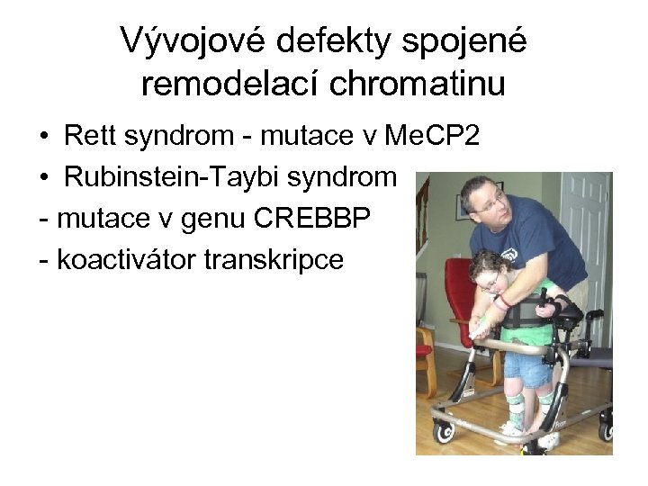 Vývojové defekty spojené remodelací chromatinu • Rett syndrom - mutace v Me. CP 2