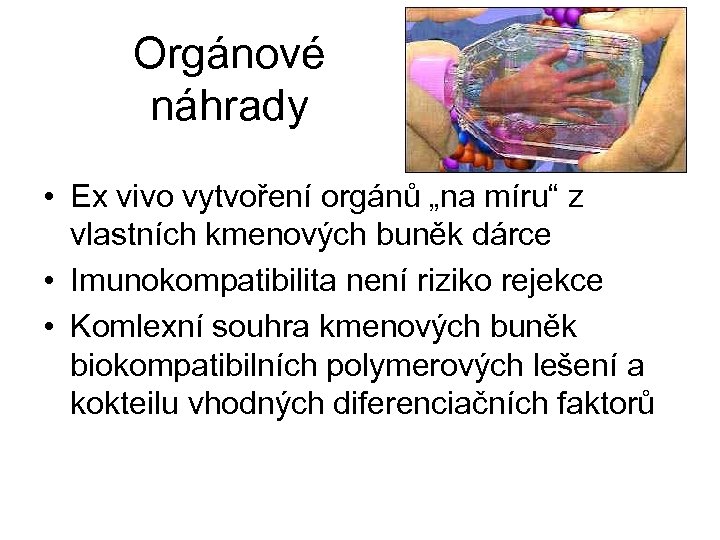 Orgánové náhrady • Ex vivo vytvoření orgánů „na míru“ z vlastních kmenových buněk dárce