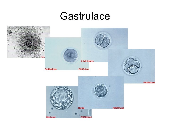 Gastrulace 