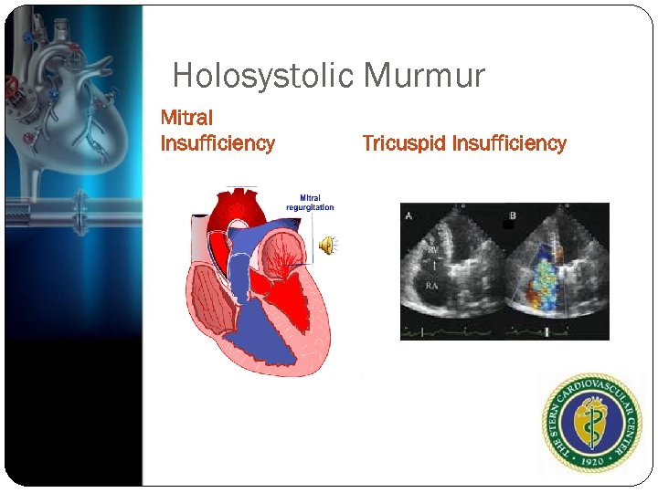 Holosystolic Murmur Mitral Insufficiency Tricuspid Insufficiency 