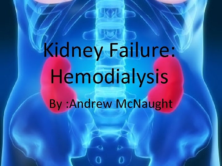 Kidney Failure: Hemodialysis By : Andrew Mc. Naught 