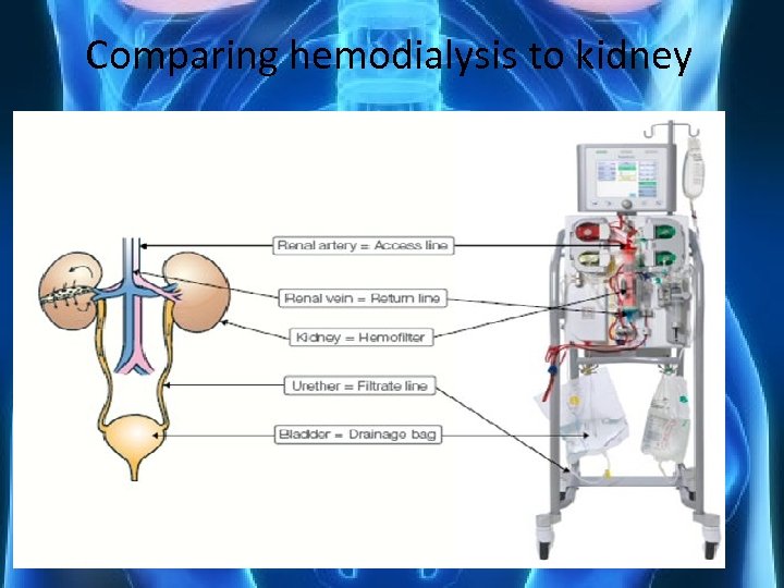 Comparing hemodialysis to kidney 