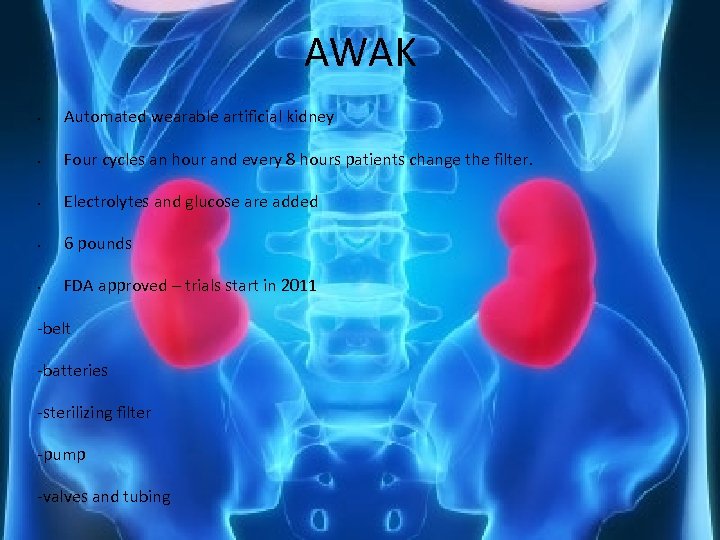 AWAK • Automated wearable artificial kidney • Four cycles an hour and every 8