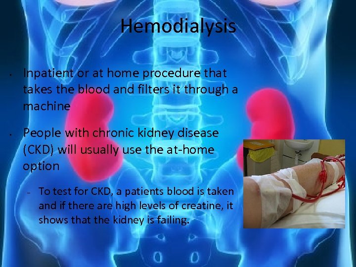 Hemodialysis • • Inpatient or at home procedure that takes the blood and filters