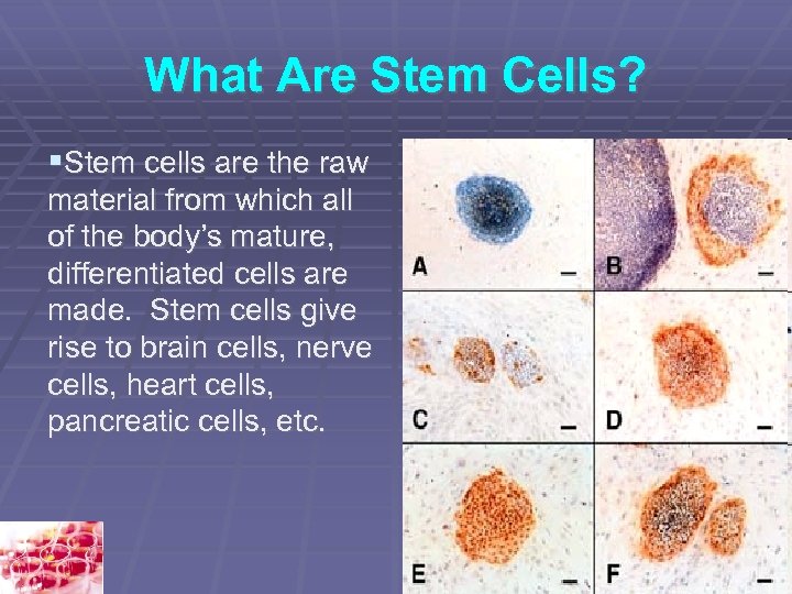What Are Stem Cells? Stem cells are the raw material from which all of