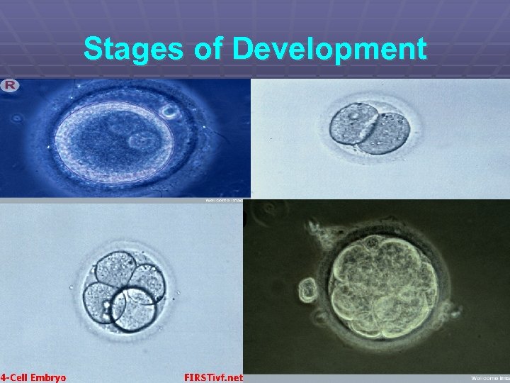 Stages of Development 