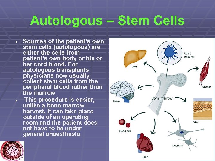 Autologous – Stem Cells Sources of the patient's own stem cells (autologous) are either