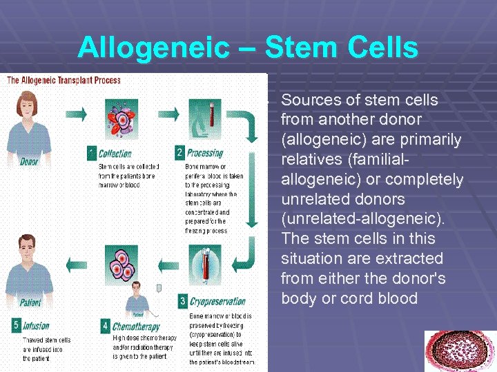 Allogeneic – Stem Cells Sources of stem cells from another donor (allogeneic) are primarily