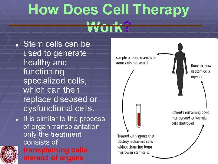 How Does Cell Therapy Work? Stem cells can be used to generate healthy and