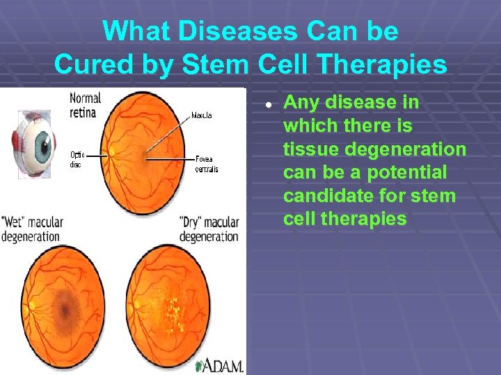 What Diseases Can be Cured by Stem Cell Therapies Any disease in which there