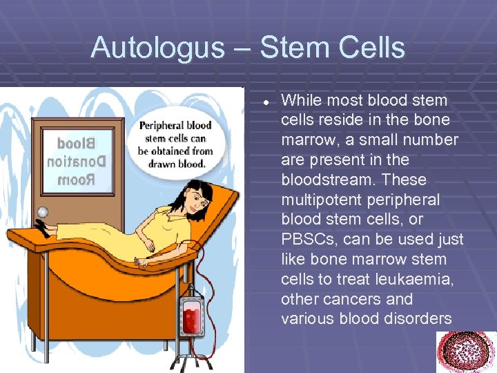 Autologus – Stem Cells While most blood stem cells reside in the bone marrow,